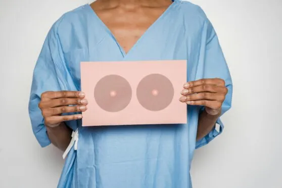 Silicone nos seios em Belo Horizonte Silicone nos seios em Belo Horizonte
